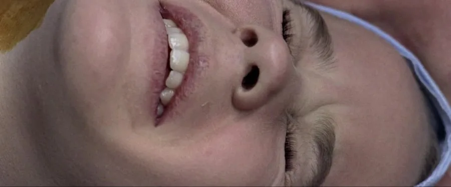 Frame 2